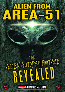 Alien From Area 51: The Alien Autopsy Footage Revealed