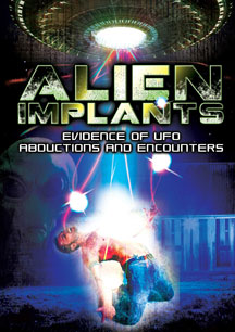 Alien Implants: Evidence Of UFO Abductions And Encounters