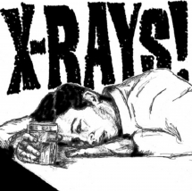 Xrays - Jameson Shot